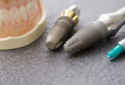 インプラントの埋入